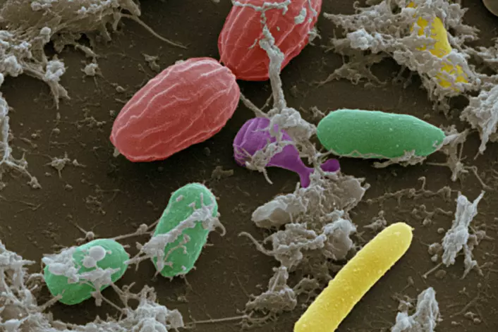 Tarmbakterier sett gjennom et skanningelektronmikroskop. (Foto: Science Photo Library)