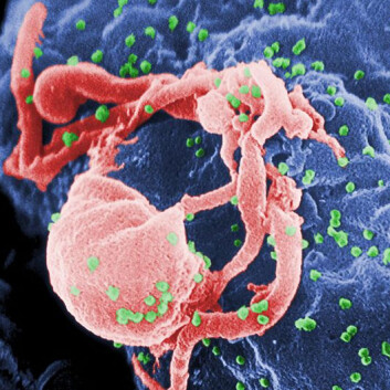 HIV-virus under et elektronmikroskop, de små, grønne prikkene er HIV-virus. HIV-virus under et elektronmikroskop, de små, grønne prikkene er HIV-virus.