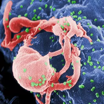 HIV-virus under et elektronmikroskop, de små, grønne prikkene er HIV-virus.