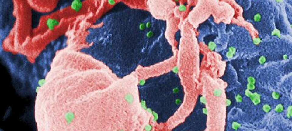 HIV-virus under et elektronmikroskop, de små, grønne prikkene er HIV-virus.