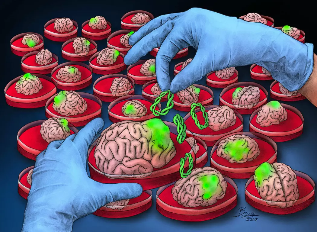 Ved å dyrke små hjerner på laboratoriet kan forskere teste ut nye behandlinger for hjernesykdom. Her er en kunstners tolkning av det å gro hjernekreft i en skål. I virkeligheten er dagens dyrkede minihjerner langt mindre, bare noen få millimeter, og ser annerledes ut. (Illustrasjon: BeataScienceArt/ IMBA).