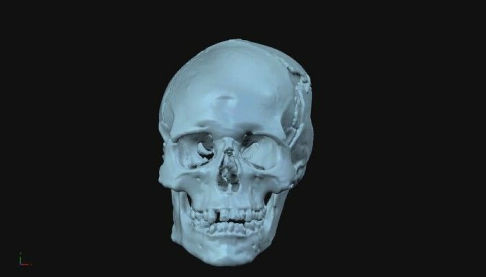 Forskerne begynte med hodeskallen. (Bilde: National Geographic)