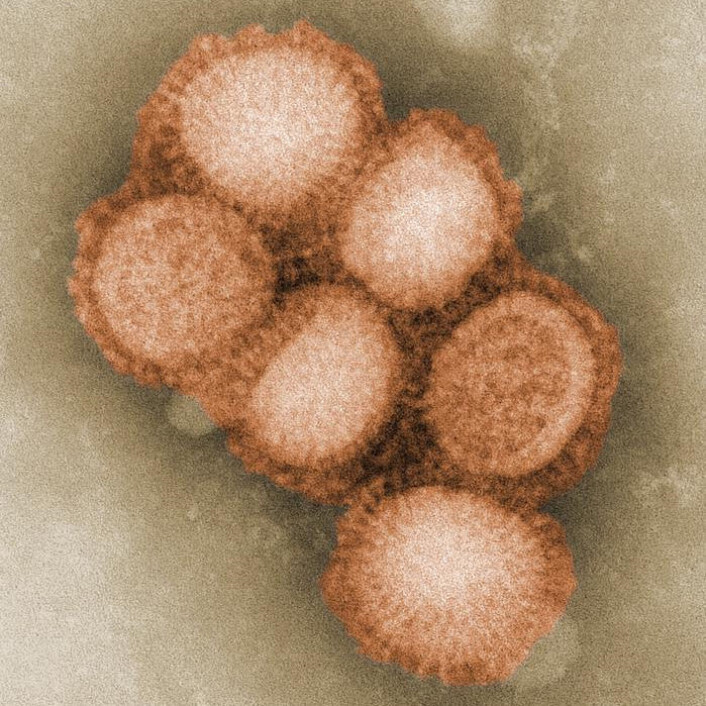Influensa A-virus. Fargelagt versjon. Foto: C. S. Goldsmith og A. Balish Influensa A-virus. Fargelagt versjon. Foto: C. S. Goldsmith og A. Balish