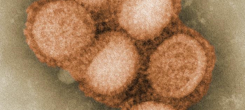 Influensa A-virus. Fargelagt versjon. Foto: C. S. Goldsmith og A. Balish