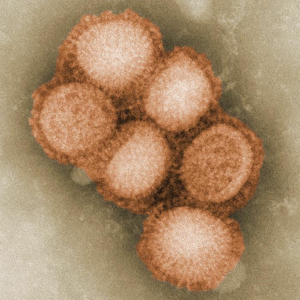 Influensa A-virus. Fargelagt versjon. Foto: C. S. Goldsmith og A. Balish