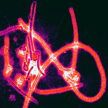 Ebola skremte vannet av oss på 1990-tallet, men hvor ble den av? (Foto: (Illustrasjon: Thomas W. Geisbert, Boston University School of Medicine/Wikimedia Commons)) Ebola skremte vannet av oss på 1990-tallet, men hvor ble den av? (Foto: (Illustrasjon: Thomas W. Geisbert, Boston University School of Medicine/Wikimedia Commons))