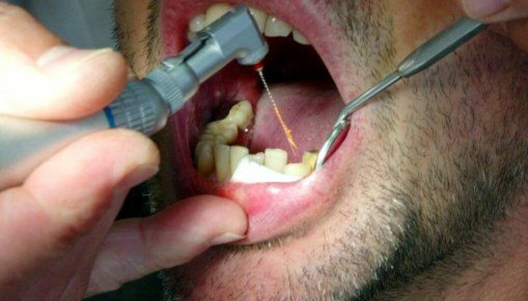 Kalsiummangel gjør menn tannløse