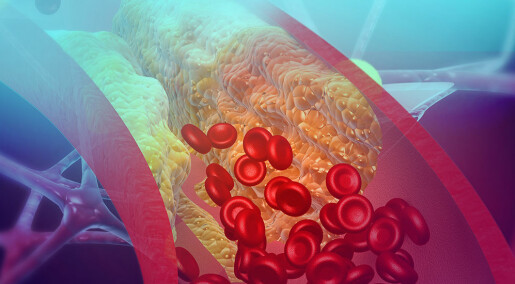 Kolesterolkrystaller kan aktivere blodpropp