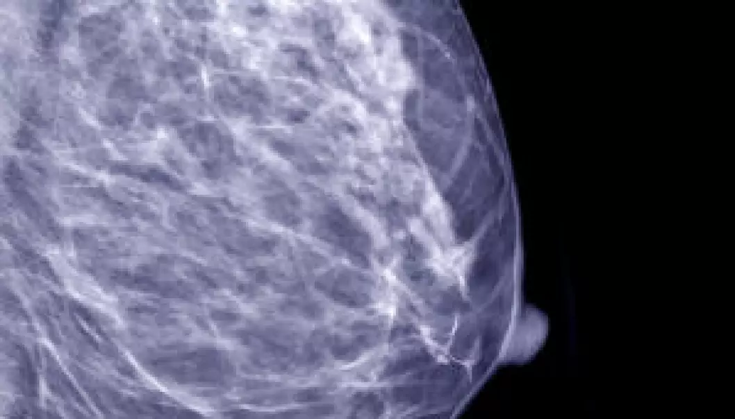 Mammografi reduserte dødsrisiko