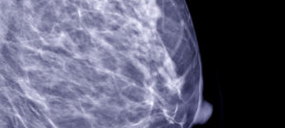 Mammogram. Istockphoto