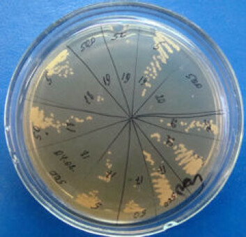 Borpeptider testes på tuberkulosebakterier i laboratoriet. Her ser vi tuberkulosebakterier som vokser på en petriskål. (Foto: UiT) Borpeptider testes på tuberkulosebakterier i laboratoriet. Her ser vi tuberkulosebakterier som vokser på en petriskål. (Foto: UiT)