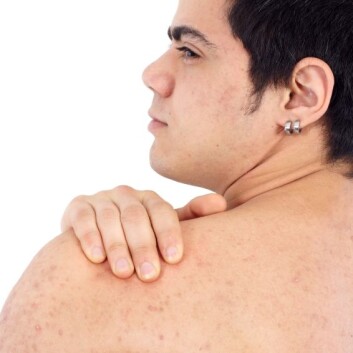 (Foto: iStockphoto) (Foto: iStockphoto)