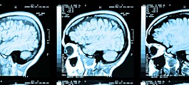 Er det sant at vi bare bruker en liten del av hjernen?