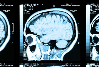 Er det sant at vi bare bruker en liten del av hjernen?