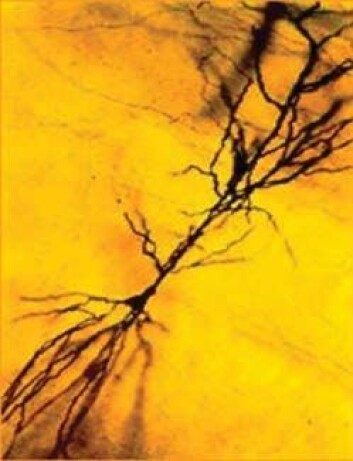 "Bildet viser en enkelt nervecelle i hippocampus. I enden av hver nervetråd er det en nerveterminal, såkalt synapse. Hver celle kan ha 10.000 synapser. (ill. Kristen Harris)" "Bildet viser en enkelt nervecelle i hippocampus. I enden av hver nervetråd er det en nerveterminal, såkalt synapse. Hver celle kan ha 10.000 synapser. (ill. Kristen Harris)"