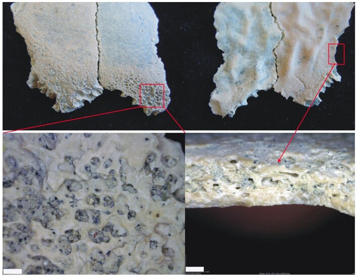 Utsnittsbildene av hodeskallen til OH 81 viser tydelig den deformerte beinveksten som til slutt tok livet av toåringen. Forskerne tror det skyldes kjøttmangel. (Foto: Domíngues-Rodrigo et al. 2012/PLoS One) Utsnittsbildene av hodeskallen til OH 81 viser tydelig den deformerte beinveksten som til slutt tok livet av toåringen. Forskerne tror det skyldes kjøttmangel. (Foto: Domíngues-Rodrigo et al. 2012/PLoS One)