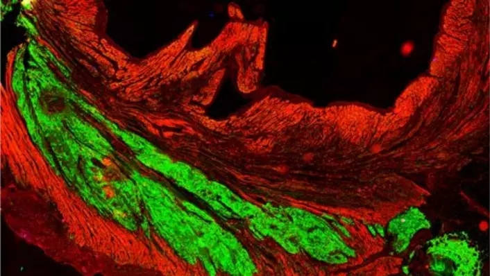 Stamceller kan ifølge forskere bli fremtidens behandlingsmiddel for forskjellige hjertesykdommer. På bildet ser du hvordan hjerteceller fra mennesker (grønt) har blitt til muskelvev i hjertet hos en ape. (Foto: Murry Lab/University of Washington)