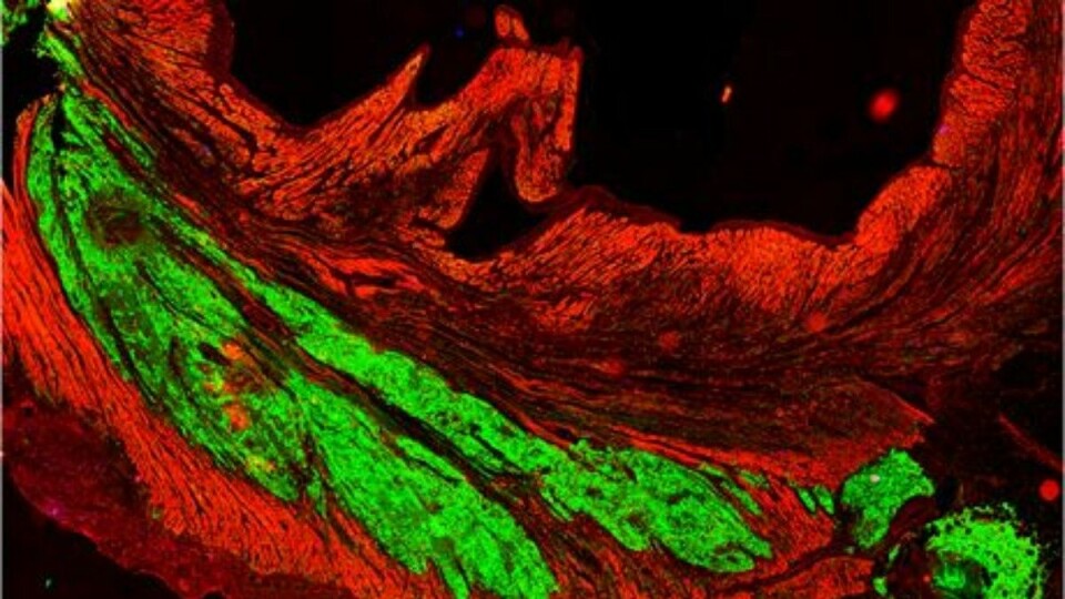 Stamceller kan ifølge forskere bli fremtidens behandlingsmiddel for forskjellige hjertesykdommer. På bildet ser du hvordan hjerteceller fra mennesker (grønt) har blitt til muskelvev i hjertet hos en ape. (Foto: Murry Lab/University of Washington)