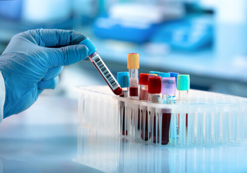 Proteins in blood test can reveal and predict disease
