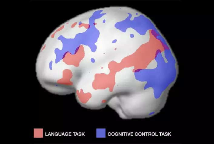Fra en tidligere kortnytt-melding hos forskning.no: De røde områdene viser aktive områder ved språkbruk, og de blå viser aktive ormåder ved en annen sammenlignende tankevirksomhet, for kontroll. (Foto: (Figur: Fedorenko et al, MIT))