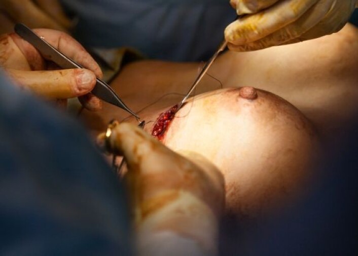 Kvinner får implantater av ulike grunner. Det kan være viktig for mange å få nytt bryst hvis de har fjernet eller delvis fjernet det gamle på grunn av kreft. (Foto: Istockphoto) Kvinner får implantater av ulike grunner. Det kan være viktig for mange å få nytt bryst hvis de har fjernet eller delvis fjernet det gamle på grunn av kreft. (Foto: Istockphoto)
