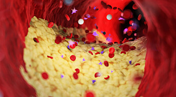 Forskere har laget en nanopartikkel som lurer immunceller til å spise plakk i blodårene