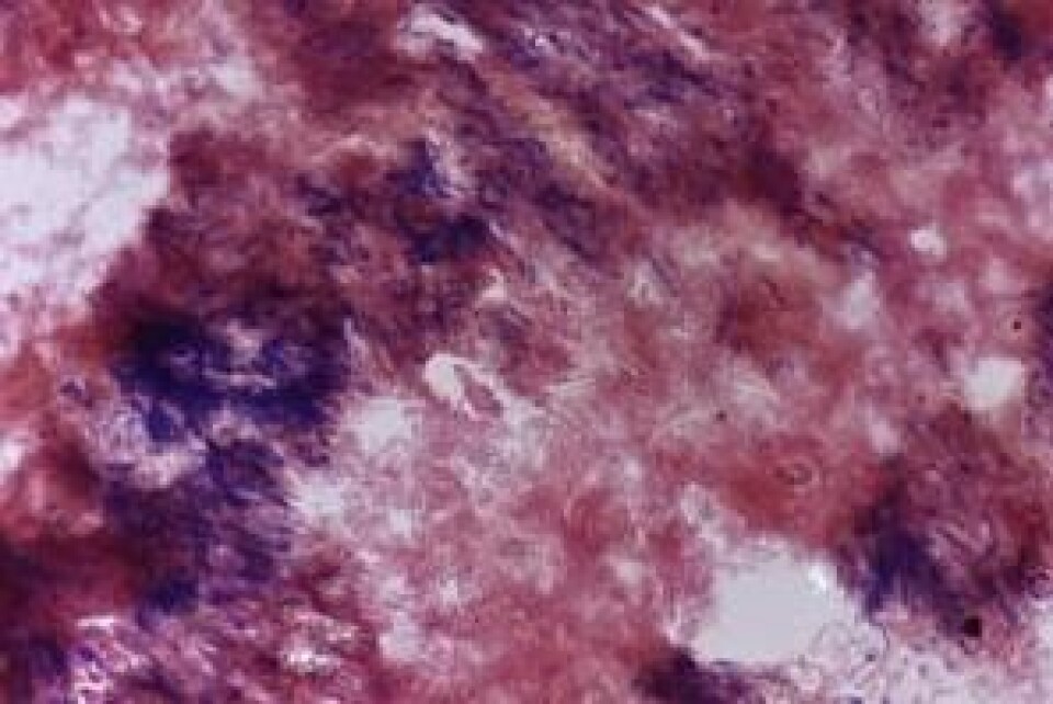 Her er den gamle tannsteinen forstørret 1000 ganger. Bildet avslører millioner av forsteinede bakterier, grampositive (blå) og gramnegative (røde). (Foto: Natallia Shved)