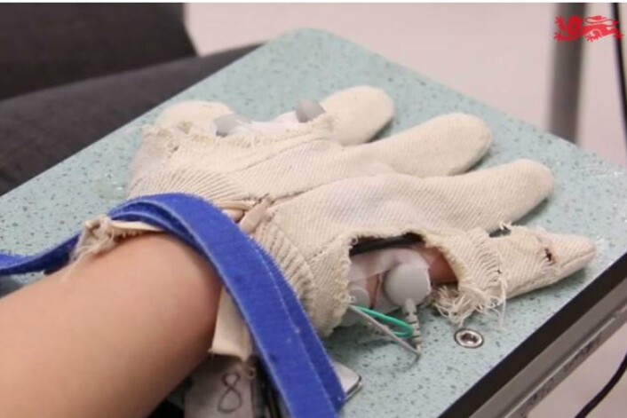 Forskere tror de kan hjelpe personer som har blitt lam etter hjerneslag. (Foto: Newcstle University) Forskere tror de kan hjelpe personer som har blitt lam etter hjerneslag. (Foto: Newcstle University)