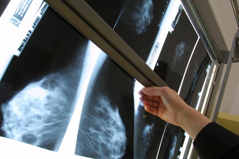 I England har forskeres kritikk av mammografiscreeningprogrammet vært så kraftig at myndighetene nå tar konsekvensen og gjennomgår saken på nytt. (Foto: Colourbox)