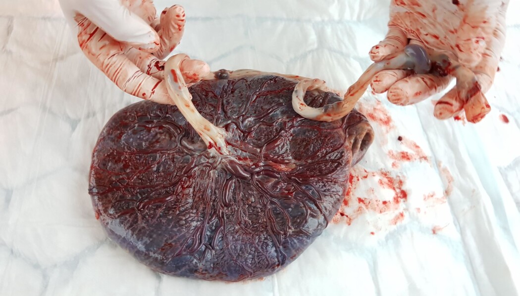 Morkaken veier rundt en halv kilo når barnet blir født. Under graviditeten har det blodige organet erstattet både lungene og fordøyelsessystemet til fosteret. Morkaken veier rundt en halv kilo når barnet blir født. Under graviditeten har det blodige organet erstattet både lungene og fordøyelsessystemet til fosteret.