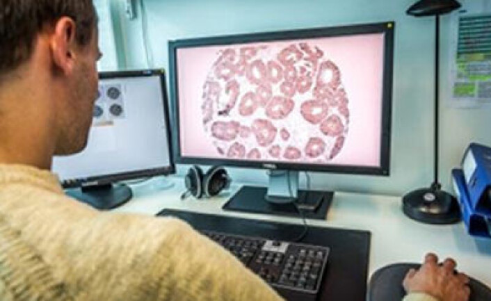 Forskerne studerte utsnitt av tarmkreftsvulster, for å finne kjennetegn på tilbakefall. (Foto: Jarle Bruun) Forskerne studerte utsnitt av tarmkreftsvulster, for å finne kjennetegn på tilbakefall. (Foto: Jarle Bruun)