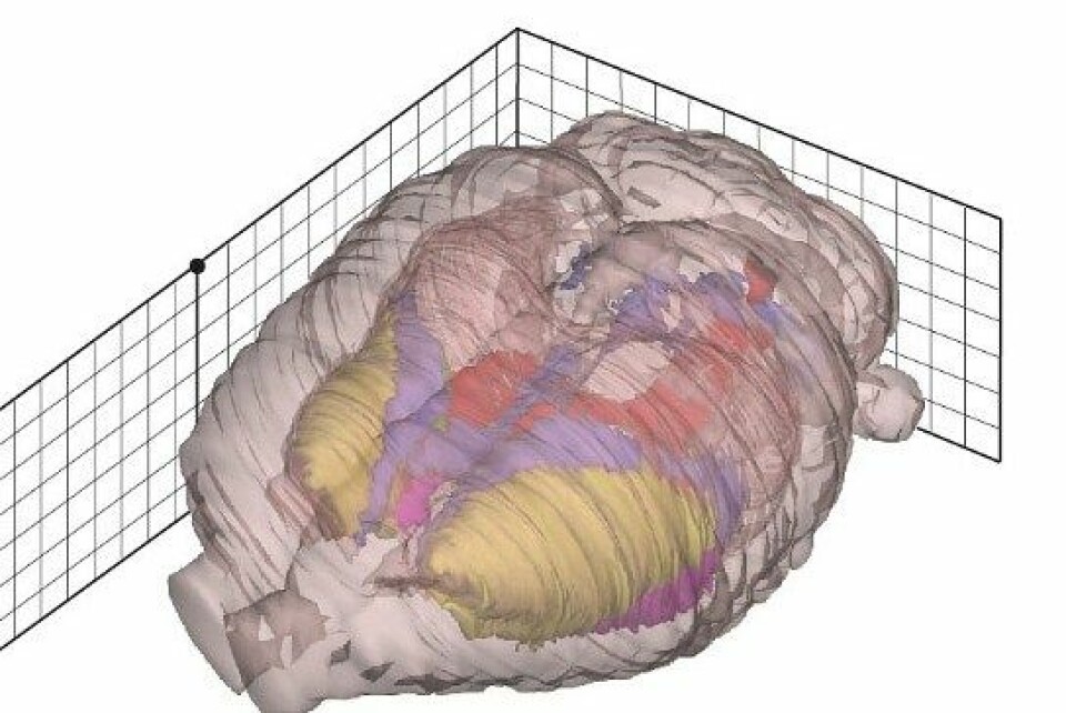 Hjernen skal kartleggjast i eit digitalt hjerneatlas som del av eit stort hjerneprosjekt. NB på biletet ser vi ein rottehjerne. (Foto: T. B. Leergaard, J.G. Bjaalie, NeSys-gruppen, UiO)