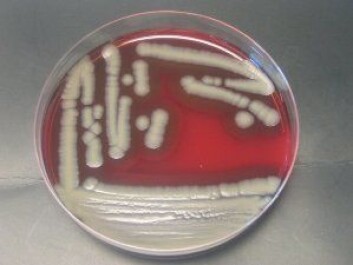Vekst av Bacillus cereus på blodskål. (Foto: Hilde Mellegård) Vekst av Bacillus cereus på blodskål. (Foto: Hilde Mellegård)