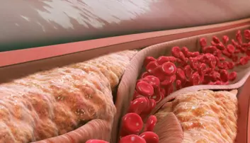 Blodpropp-enzym kan vere del av kroppen sitt forsvarssystem