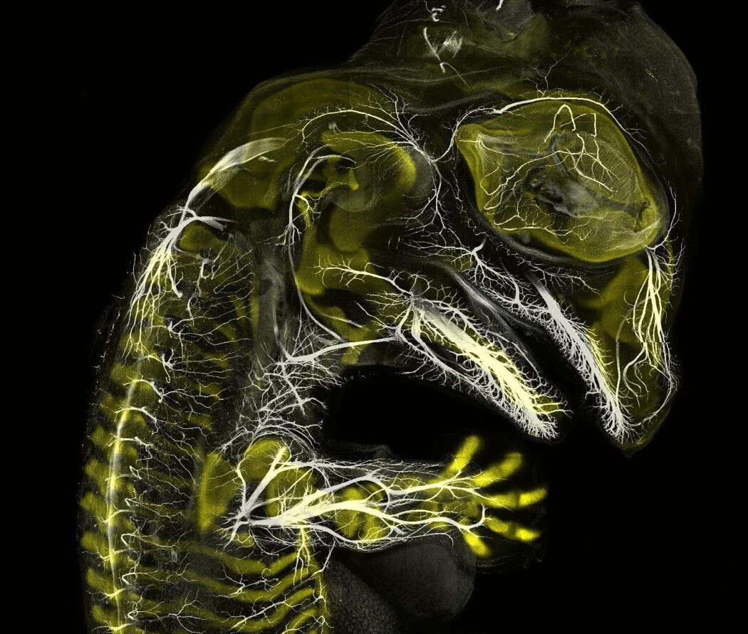 3. plassen gikk til et bilde av en ufødt alligator. (Foto: Daniel Smith Paredes og Bhart-Anjan S. Bhulla) 3. plassen gikk til et bilde av en ufødt alligator. (Foto: Daniel Smith Paredes og Bhart-Anjan S. Bhulla)