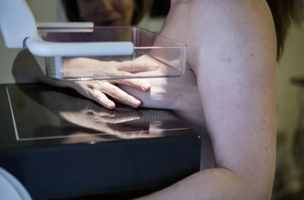 Informasjon om overdiagnostikk er sendt ut sammen med invitasjonen til å delta i mammografiscreening siden 2009. Informasjon om overdiagnostikk er sendt ut sammen med invitasjonen til å delta i mammografiscreening siden 2009.