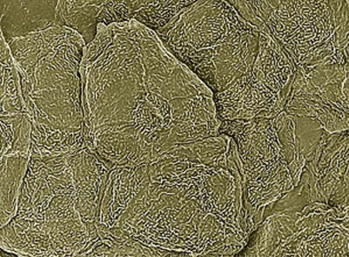 Mikroskopbilde av hudceller. (Foto: Thomas Deerinck, National Center for Microscopy and Imaging Research, UC San Diego.) Mikroskopbilde av hudceller. (Foto: Thomas Deerinck, National Center for Microscopy and Imaging Research, UC San Diego.)