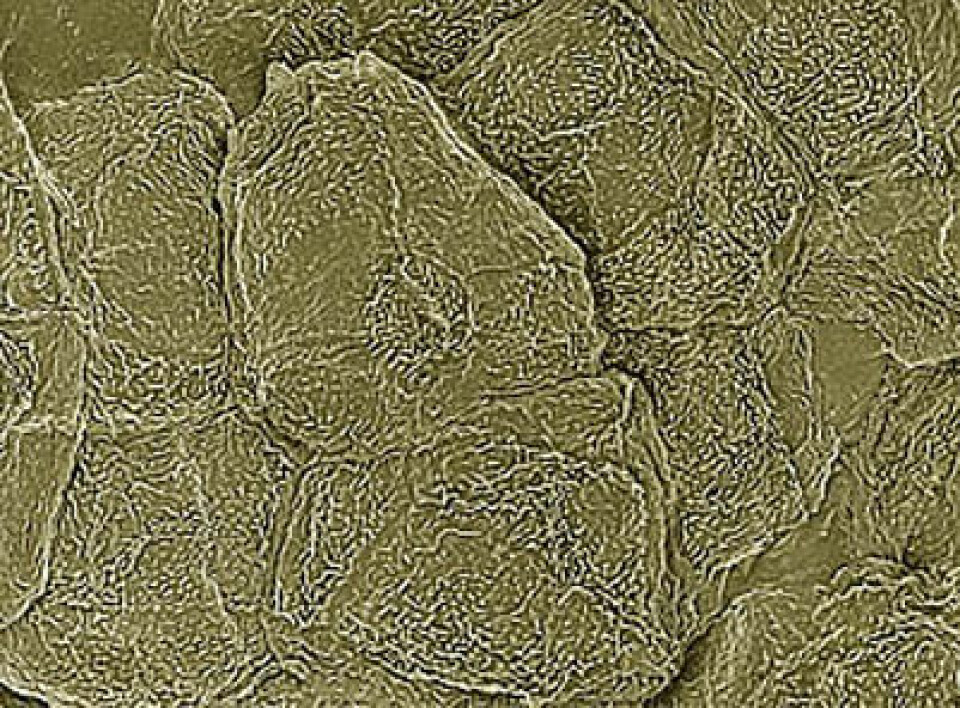 Mikroskopbilde av hudceller. (Foto: Thomas Deerinck, National Center for Microscopy and Imaging Research, UC San Diego.)
