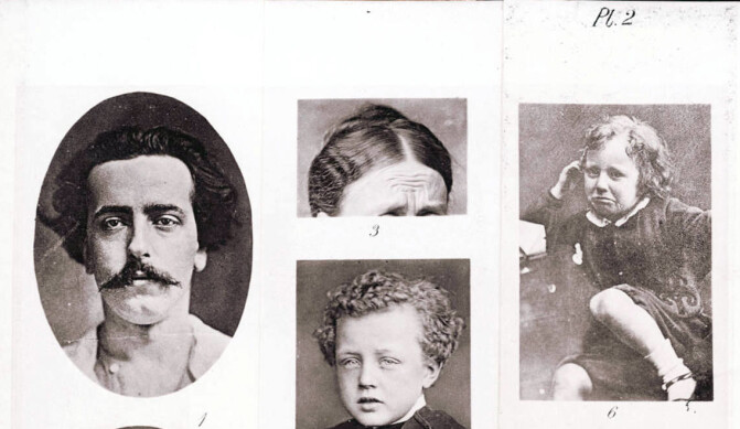 Illustrasjoner av sorg, fra Charles Darwins "The Expressions of Emotions in Man and Animals", som ble publisert i 1872. Illustrasjoner av sorg, fra Charles Darwins "The Expressions of Emotions in Man and Animals", som ble publisert i 1872.