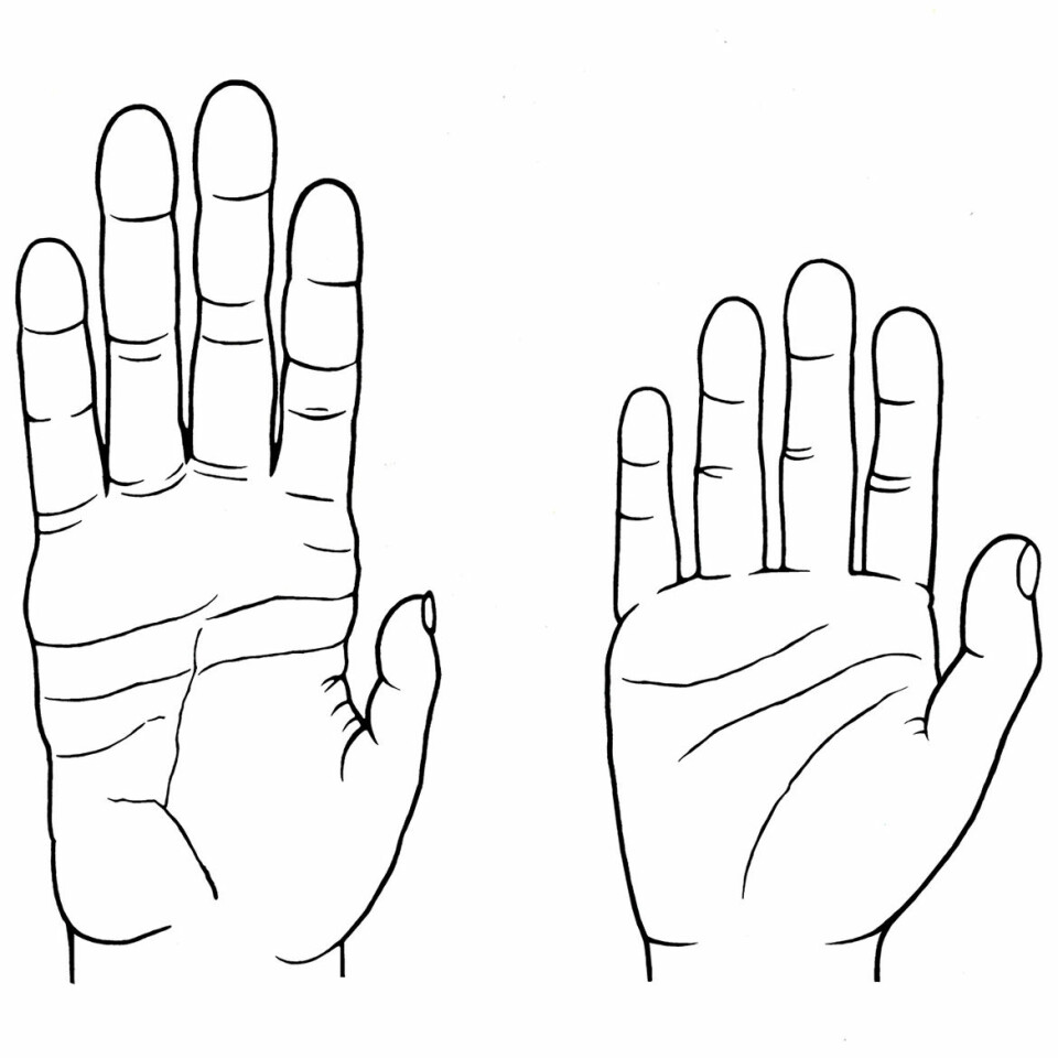 Sammenlignet med hånden til en sjimpanse (til venstre) er menneskets hånd utstyrt med kortere fingre og flate, men med en lengre, sterkere og mer fleksibel tommel. Dette betyr ikke bare at vi kan benytte verktøy og andre ting med stor presisjon, men også at vi kan knytte neven hardt sammen, noe aper ikke kan. (Foto: (Illustrasjon: Denise Morgan, University of Utah))
