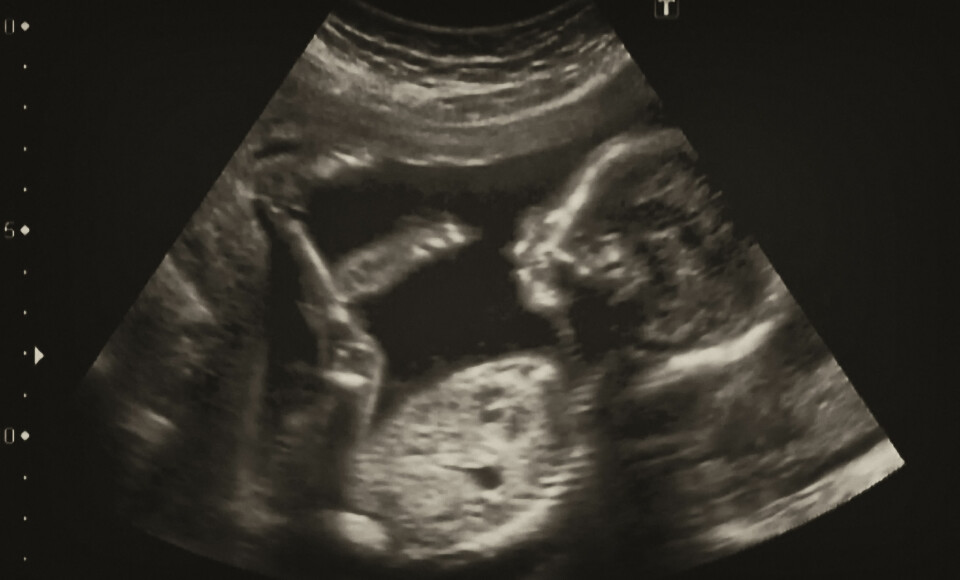 Bilde av foster fra ultralydundersøkelse. (Foto: Colourbox)