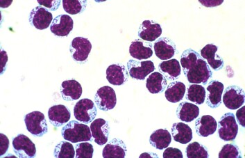 Naturlig drapsceller (NK-celler) kan være en en del av løsningen på farlige bivirkninger ved stamcelletransplantasjon. (Foto: Bent Rolstad) Naturlig drapsceller (NK-celler) kan være en en del av løsningen på farlige bivirkninger ved stamcelletransplantasjon. (Foto: Bent Rolstad)