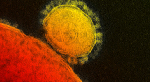 Spanskesyken, svineinfluensaen, SARS og MERS kan hjelpe oss å forstå Covid-19