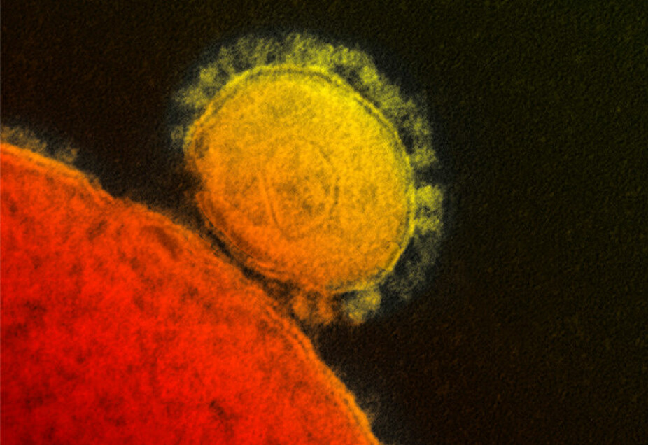 MERS-koronaviruset sett gjennom et elektronmikroskop.