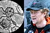 Borreliose Lars Monsen