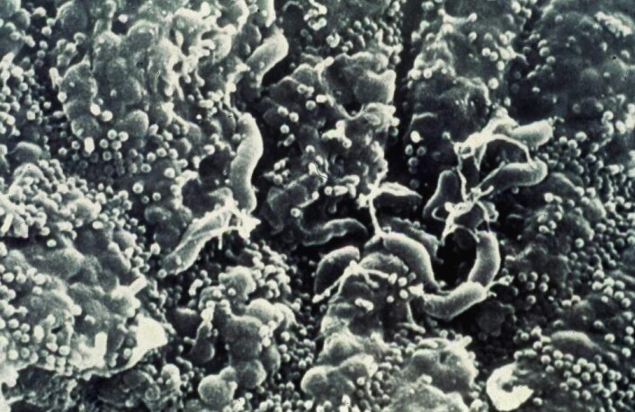 "Magebakterien helicobakter pylori er i ferd med å utryddes. Forskerne fra NYU mener overbruk av antibiotika har skylden. (Foto: NYU Langone Medical Center)" "Magebakterien helicobakter pylori er i ferd med å utryddes. Forskerne fra NYU mener overbruk av antibiotika har skylden. (Foto: NYU Langone Medical Center)"