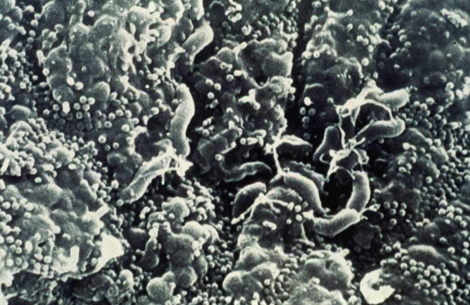 'Magebakterien helicobakter pylori er i ferd med å utryddes. Forskerne fra NYU mener overbruk av antibiotika har skylden. (Foto: NYU Langone Medical Center)'
