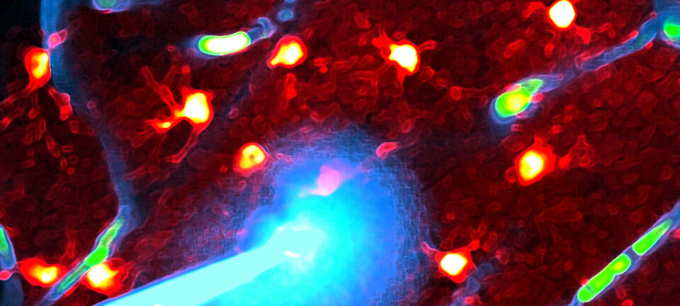 Bildet viser individuelle gliaceller dypt i hjernen på en levende mus samt en mikroelektrode som brukes for å måle elektrisk aktivitet i nervecellene avbildet med to-foton lasermikroskopi Rangroo Thrane/Thrane, UiO