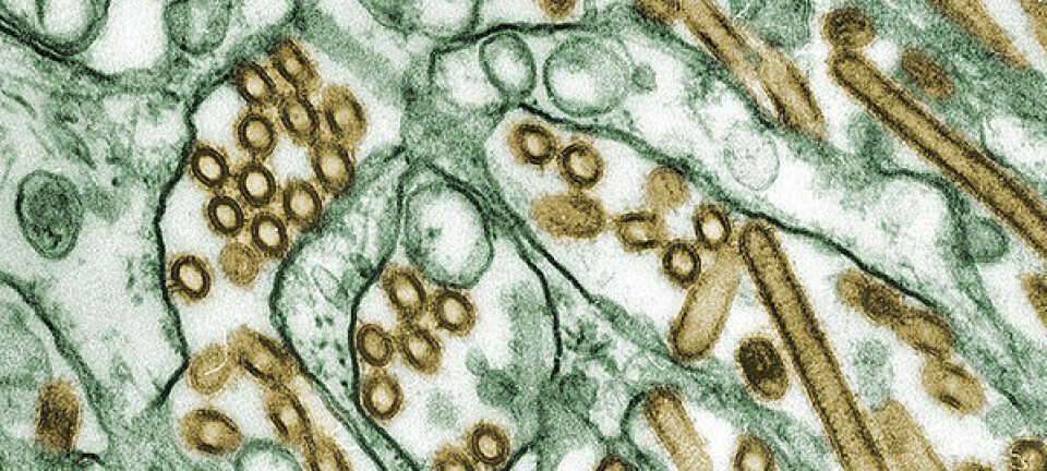 Farget elektronmikrografi av H5N1 (gulbrun) dyrket i Madin-Darby nyreceller (grønt). CDC