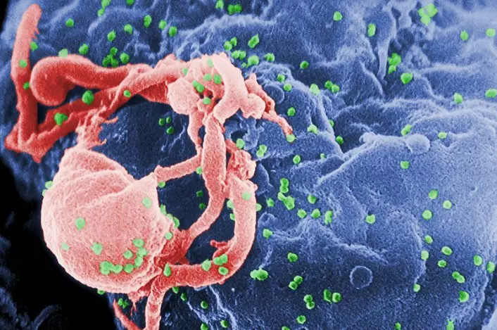 HIV-virus (grønn) som er i ferd med å angripe lymfocytt, en type hvit blodcelle (Foto: C. Goldsmith/Wikimedia Creative Commons)